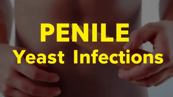 Penile Yeast Infections